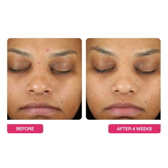 BEAUTYSTAT Universal Triple Action Daily Peel - Picture 2 of 4